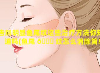 告别明显鱼尾纹这些治疗方法你知道吗(鱼尾 🐝 纹怎么消除简单方法百度百科)